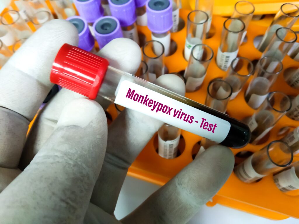 Blood Sample Tube for Monkeypox virus test